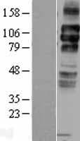 LDLR / LDL Receptor Protein (Over-Expression Lysate Myc-DDK (Flag))
