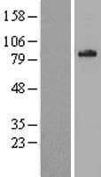 Human ALDP / ABCD1 Protein (Over-Expression Lysate Myc-DDK (Flag))