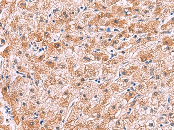IL4R / CD124 Antibody