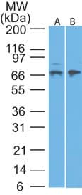 MMP2 Antibody (aa550-600)