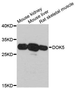 DOK5 Antibody