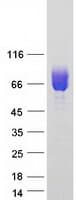 Human CSF2RA / CD116 Protein (Recombinant Myc-DDK (Flag))