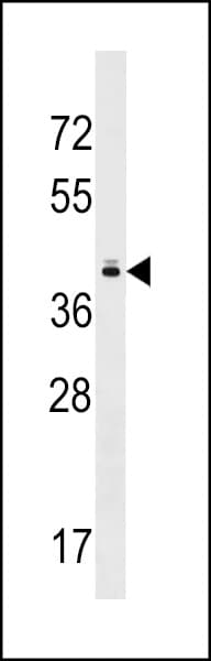 TAS2R10 / TRB2 Antibody (aa134-160)