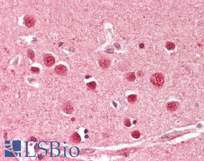 IHC-plus™ MOV10 Antibody (aa953-1003)