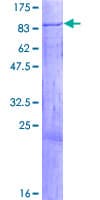 Human IGF2BP2 Protein (Recombinant GST)