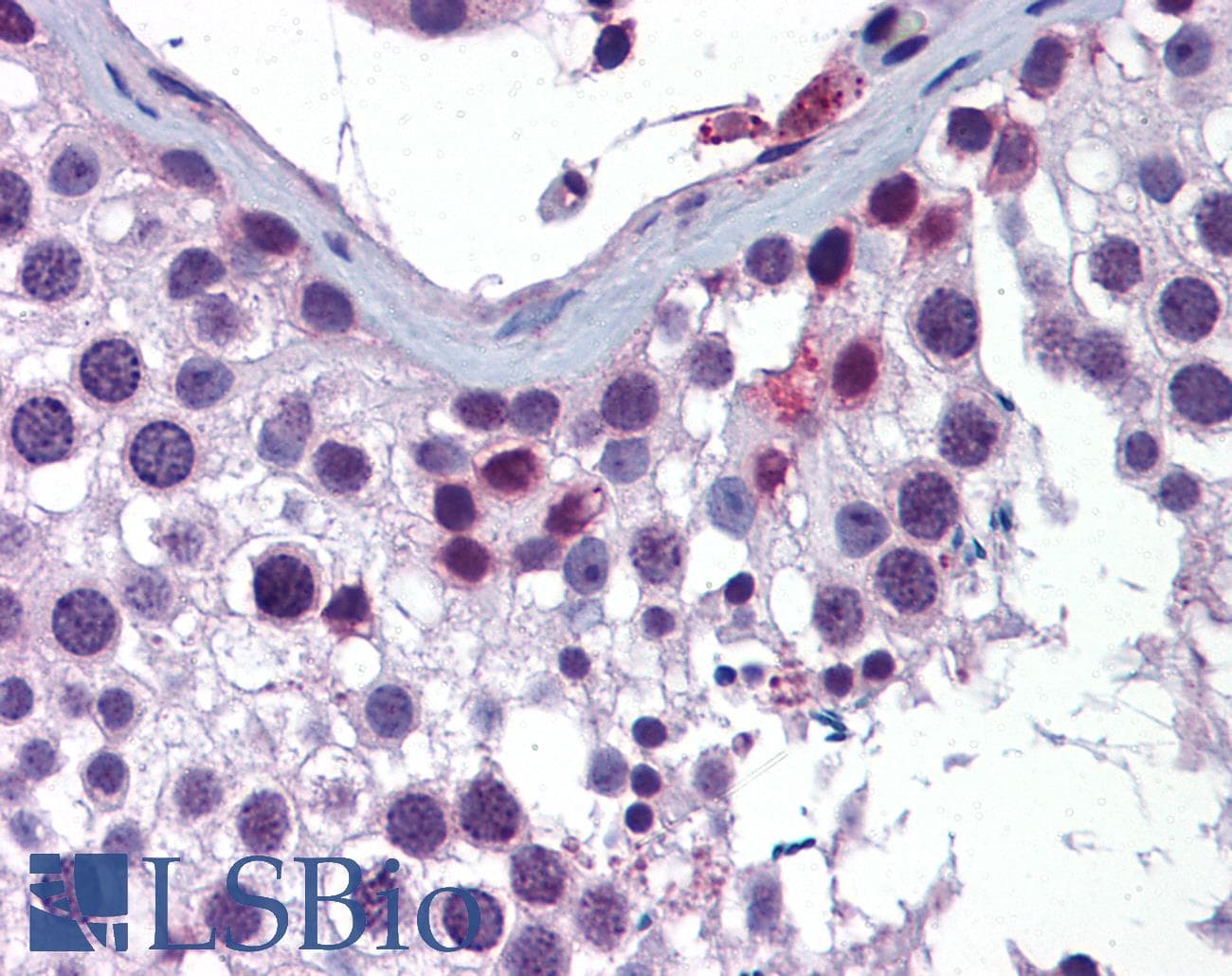 Polyclonal Rabbit anti-Human ING4 Antibody (aa110-159, IHC, WB)