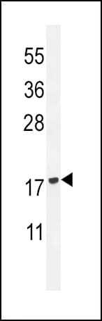 Polyclonal Rabbit anti-Human PLA2G2D Antibody (aa105-131, IHC, WB)