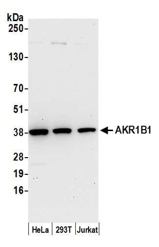 Polyclonal Rabbit anti-Human AKR1B1 / Aldose Reductase Antibody (aa100-150, WB)