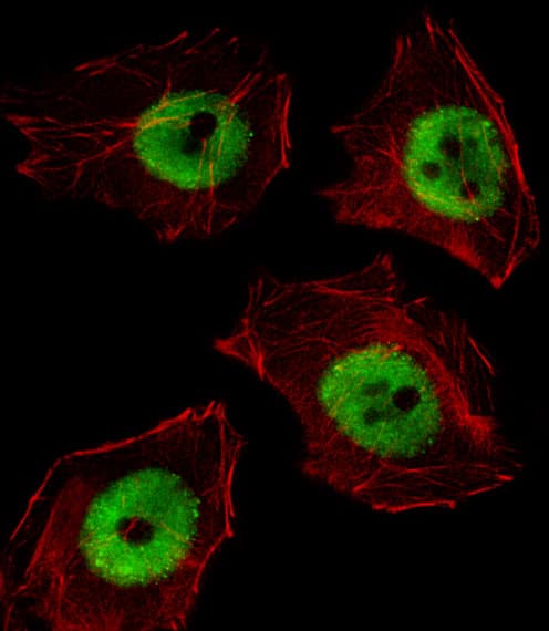 Polyclonal Rabbit anti-Human UBP1 Antibody (aa266-295, IHC, IF, WB)