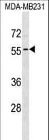 ADAT1 Antibody (aa34-60)