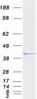 Human HPDL Protein (Recombinant Myc-DDK (Flag))