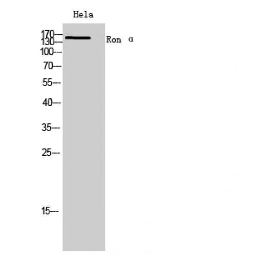 Polyclonal Rabbit anti-Human MST1R / RON Antibody (31-80 aa, N-terminal, WB)