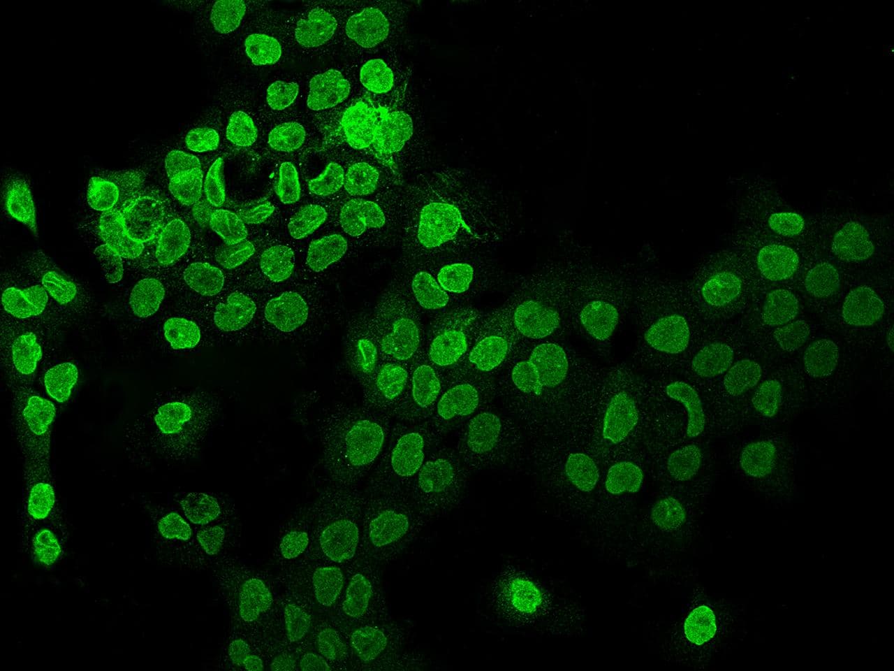 Polyclonal Rabbit anti-Human AHCTF1 / ELYS Antibody (IHC, IF)