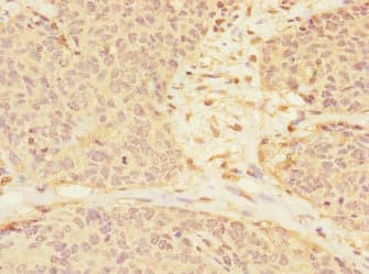 Polyclonal Rabbit anti-Human RASSF6 Antibody (IHC)