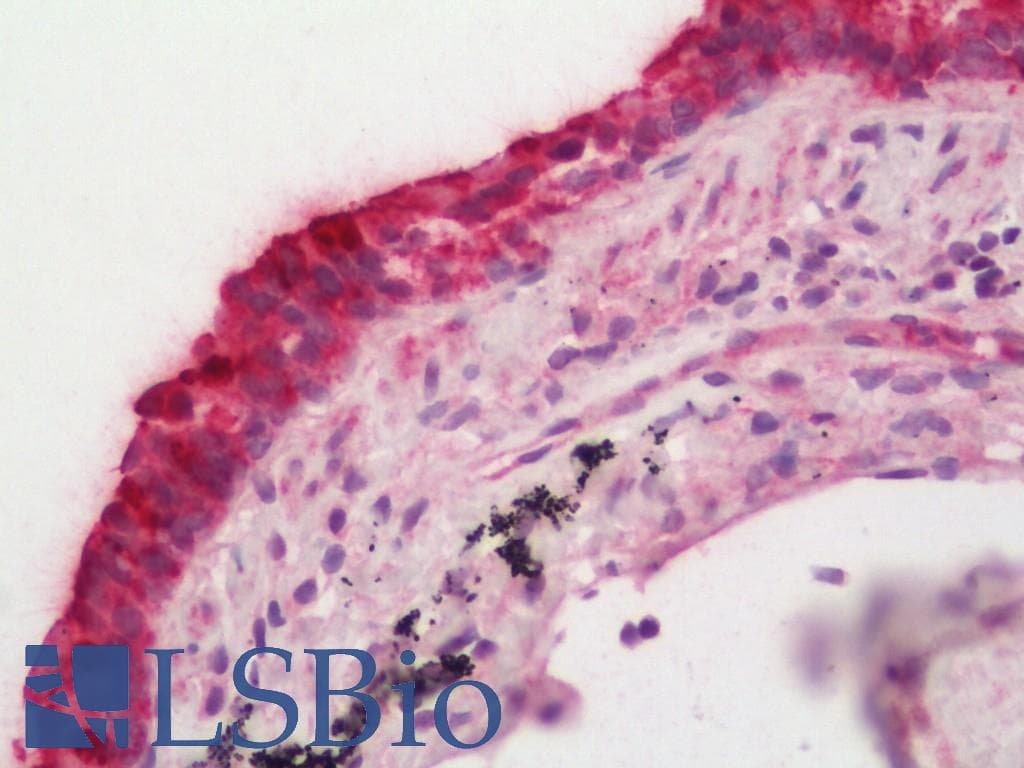 IHC-plus™ FPGT Antibody