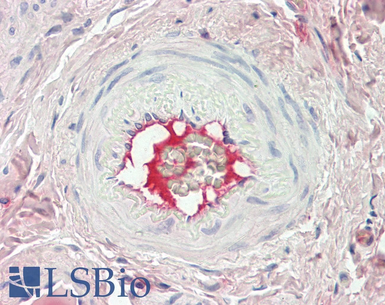 IHC-plus™ F2 / Prothrombin / Thrombin Antibody