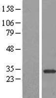 NAR / CPSF4 Protein (Over-Expression Lysate Myc-DDK (Flag))