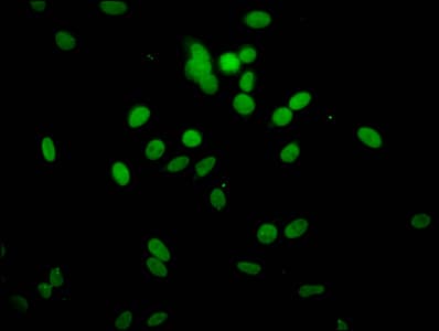 HIST1H1C Antibody