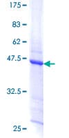 Human TPD52L1 Protein (Recombinant GST)
