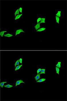 MB / Myoglobin Antibody