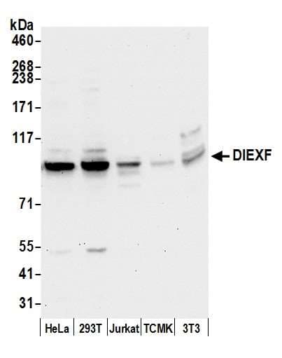 C1orf107 / DEF Antibody (aa100-150)