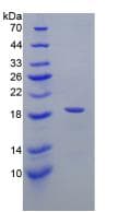 Human IL3RA / CD123 Protein (Recombinant His, N-Terminal)