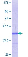 Human ETFDH Protein (Recombinant GST, N-terminus)