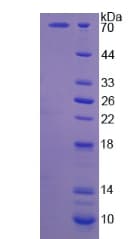 Human CAPN5 / Calpain 5 Protein (Recombinant His-GST, N-terminus)