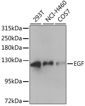 Polyclonal Rabbit anti-Human EGF Antibody (WB)