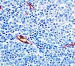 Lewis y / BG8 / CD174 Antibody (clone F3, Ready-to-Use)