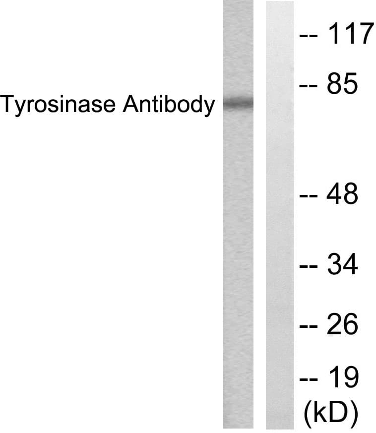 Polyclonal Rabbit anti-Human Tyrosinase Antibody (aa471-520, WB)