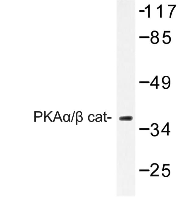 Polyclonal Rabbit anti-Human PRKACA + PRKACB Antibody (Lys17, IHC, IF, WB)