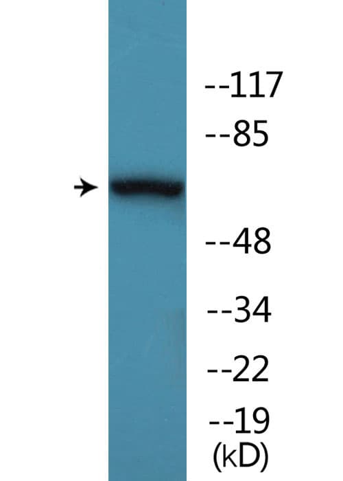 AKT1 + AKT3 Antibody (phospho-Tyr473)