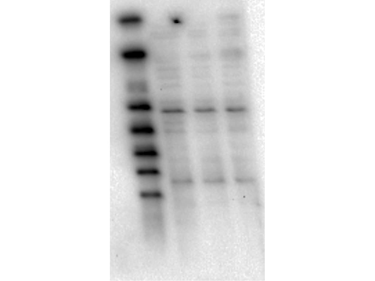Monoclonal Mouse anti-Human AKT1 Antibody (clone 5E5.F5.D7, Internal, IHC, WB)