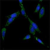 HSP70 / Heat Shock Protein 70 Antibody (clone 5A6)