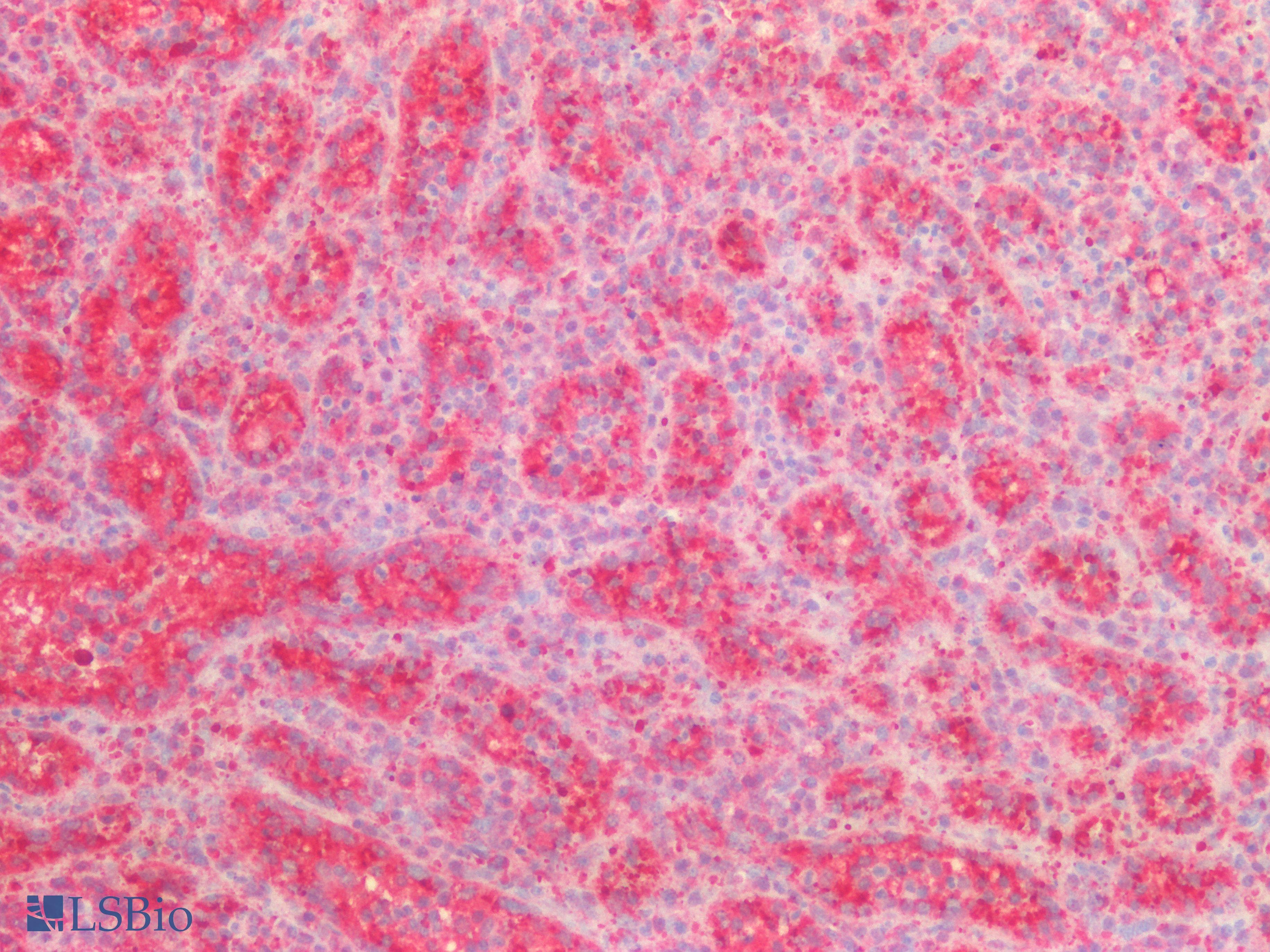 PathPlus™ VPS37A Antibody