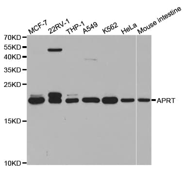 Polyclonal Rabbit anti-Human APRT Antibody (aa1-180, IHC, IF, WB)