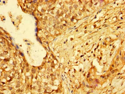 Polyclonal Rabbit anti-Human HMGB3 Antibody (IHC, WB)