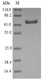 Hemophilus influenzae ompA Protein (Recombinant 10His-SUMO, N-terminus + Myc, C-terminus)