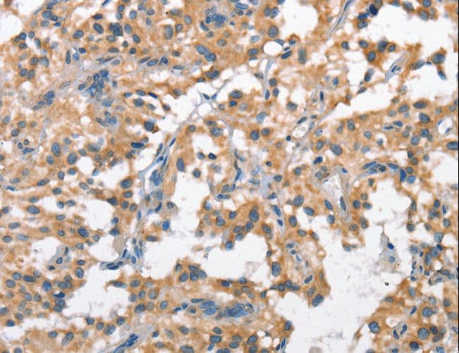 Polyclonal Rabbit anti-Human SCARB1 / SR-BI Antibody (IHC)