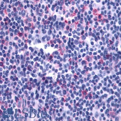 PathPlus™ LTB4R2 / BLT2 Antibody (Cytoplasmic Domain)