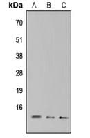 Polyclonal Rabbit anti-Human XCL1 / Lymphotactin Antibody (Internal, WB)