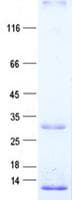 Human OIP5 Protein (Recombinant His, N-Terminal)
