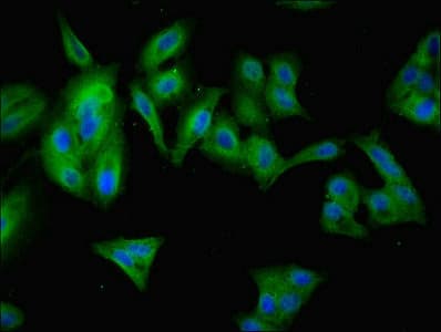ANKRD55 Antibody