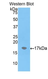 A2M / Alpha-2-Macroglobulin Antibody (aa911-1042, Cy3)