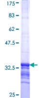 Human HELQ / HEL308 Protein (Recombinant GST)