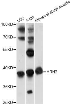 HRH2 / Histamine H2 Receptor Antibody
