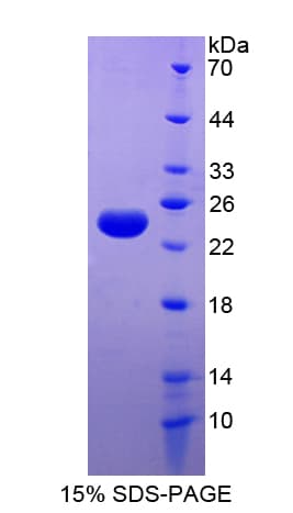 Human FTL / Ferritin Light Chain Protein (Recombinant His-T7)