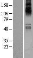 Human SLC1A7 / EAAT5 Protein (Over-Expression Lysate Myc-DDK (Flag))