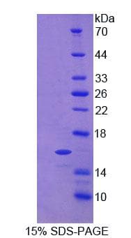 Human NPPC Protein (Recombinant His)